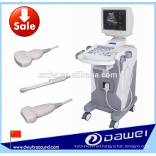 Mobile Ultrasound&B Type Ultrasoud Scanner With Cart DW350